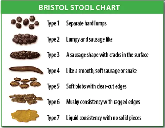 Bristol stool chart